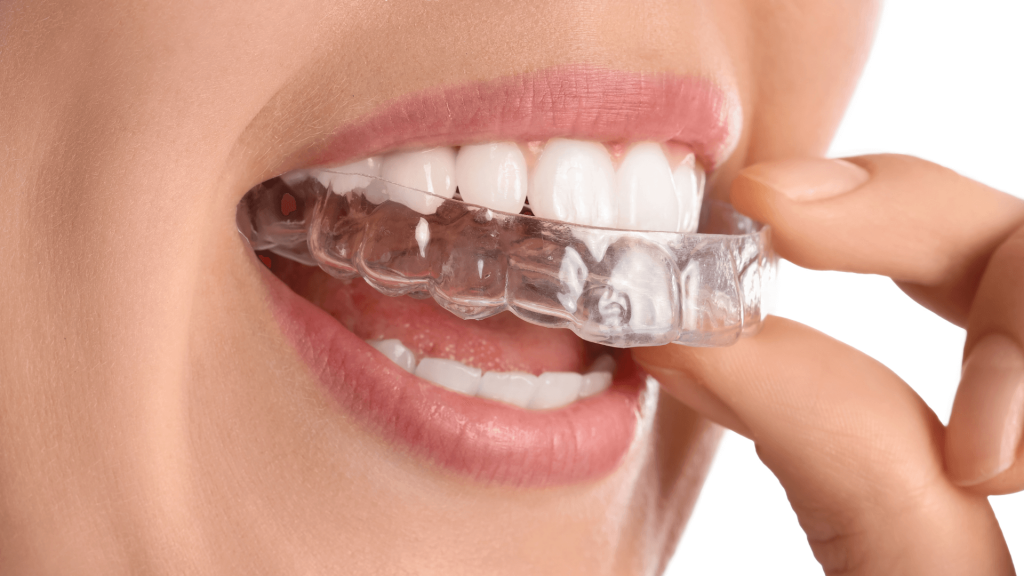 Ortodoncia Invisible blog Dentalsalud portada